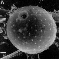 Microscopic cysts of algae from Elk Lake, MN, yield information important to our understanding of the Flood.